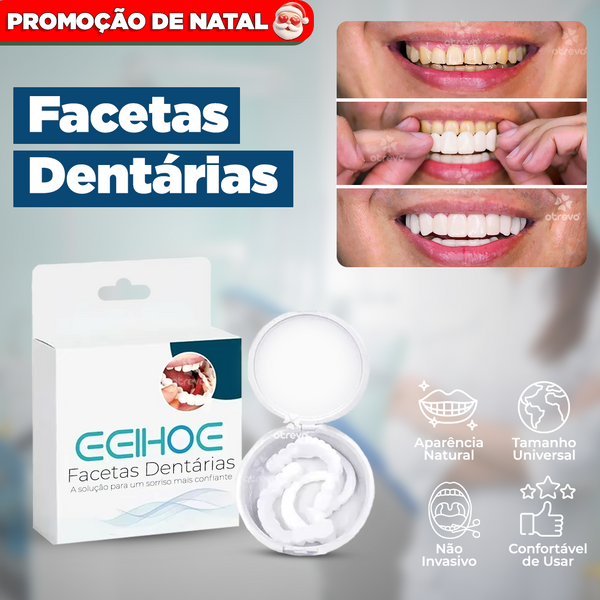 SmileFit® - Facetas Dentárias Naturais Removíveis